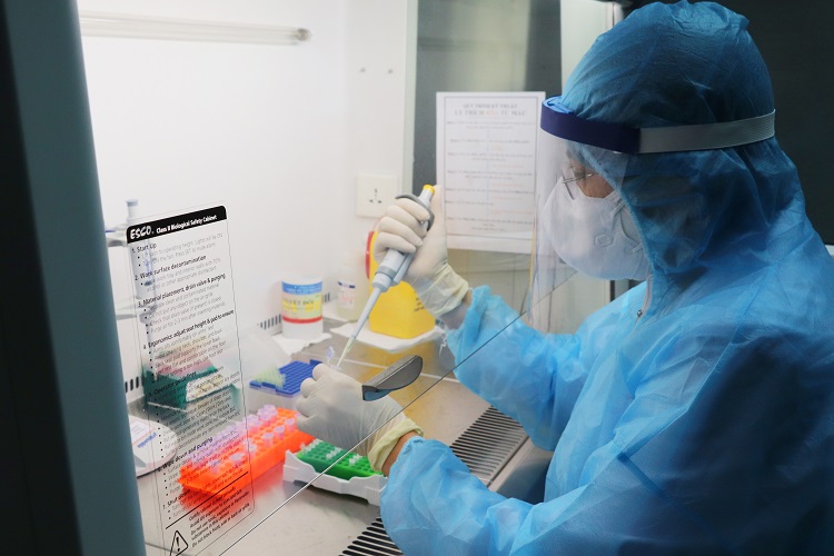 xét nghiệm sinh học phân tử chẩn đoán SARS-CoV-2 hiện đại bằng kỹ thuật Real time-PCR