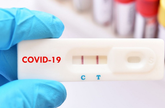 Sở Y tế Đồng Nai yêu cầu các đơn vị không thu phí xét nghiệm test nhanh COVID-19 của bệnh nhân, người nhà bệnh nhân.