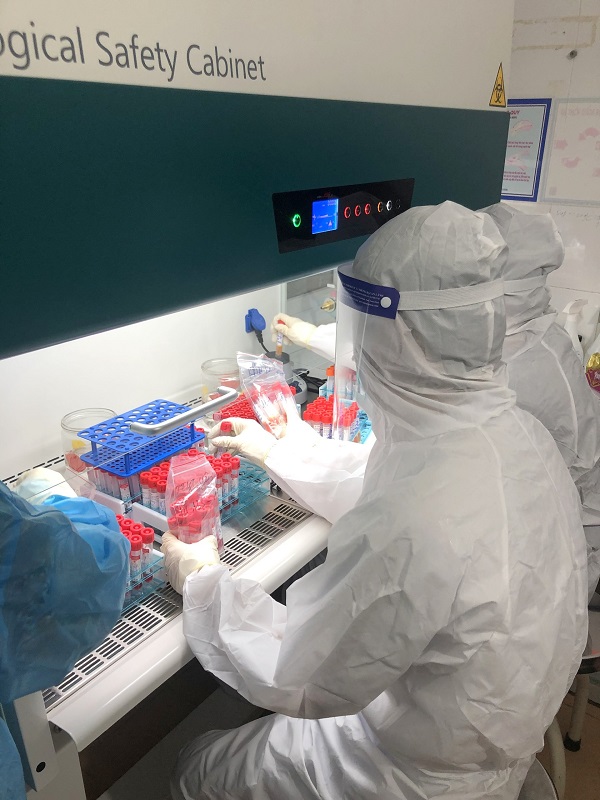 Xét nghiệm sàng lọc SARS – CoV – 2 tại Bệnh viện Đa Khoa Khu vực Yên Minh