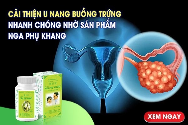 Cải thiện u nang buồng trứng nhanh chóng nhờ Nga Phụ Khang