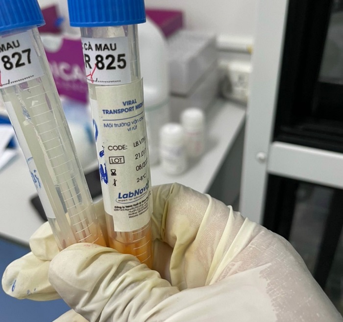 Khi phát hiện người dân có test nhanh dương tính với SARS-CoV-2 tiến hành lấy mẫu gửi xét nghiệm khẳng định bằng phương pháp RT-PCR