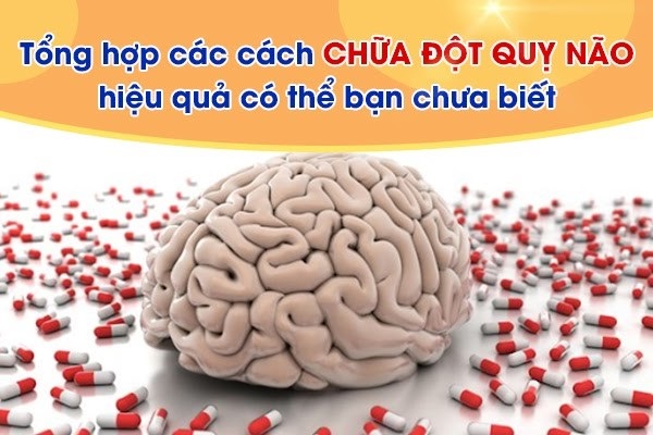 Tổng hợp các cách chữa đột quỵ não hiệu quả có thể bạn chưa biết