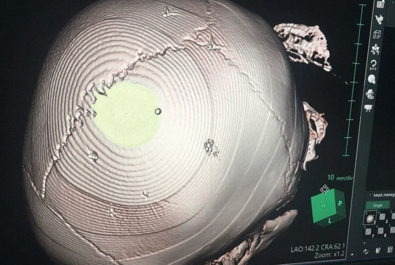 Bé gái 3 tuổi bị đóng đinh vào đầu tử vong: Kẻ thủ ác đối mặt khung hình phạt cao nhất