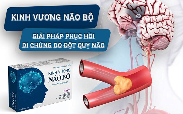 Kinh Vương Não Bộ - Giải pháp phục hồi di chứng do đột quỵ não