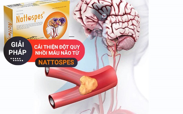 Giải pháp cải thiện đột quỵ nhồi máu não từ Nattospes