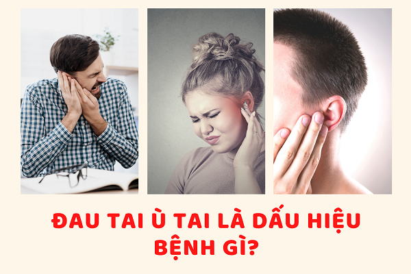 Đau tai, ù tai - Dấu hiệu bệnh lý chớ dại xem thường