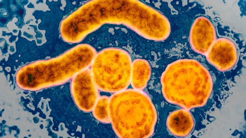 Virus adeno đã được phát hiện ở nhiều ca mắc viêm gan bí ẩn. Ảnh: Reuters.