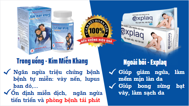Kim Miễn Khang & Explaq - Giải pháp hiệu quả cho người bệnh vảy nến