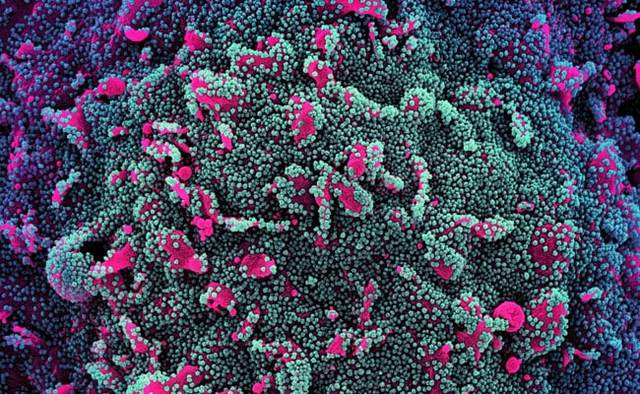 Bộ Y tế cảnh báo biến thể phụ BA.4, BA.5 lây lan nhanh, số lượng ca Covid-19 và mức độ nguy hiểm tăng