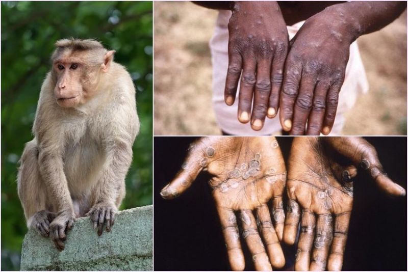 Bệnh đậu mùa khỉ là bệnh lây truyền từ động vật sang người.