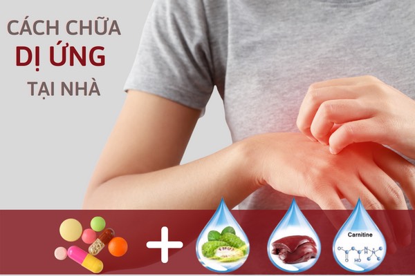 Cách chữa dị ứng tại nhà và giải pháp phòng ngừa tái phát từ Phụ Bì Khang