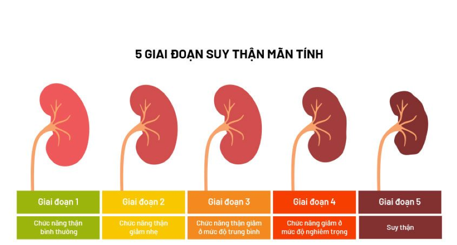 Suy thận độ 2 không được điều trị kịp thời và đúng cách có thể tiến triển sang những giai đoạn nặng hơn