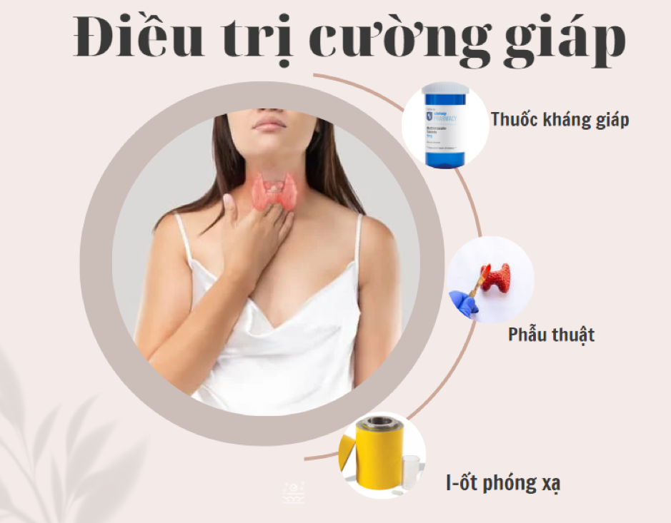 Các phương pháp điều trị cường giáp hiện nay