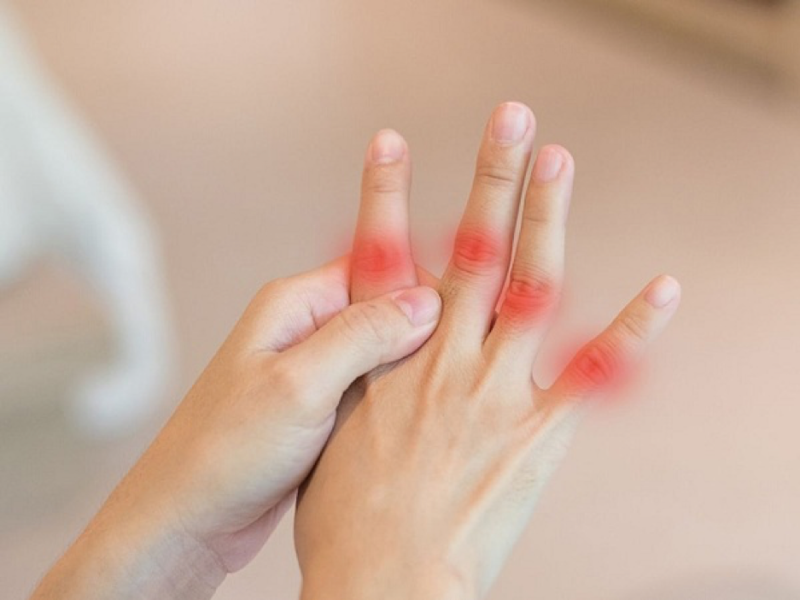 Triệu chứng của viêm khớp thường xuất hiện ở các khớp nhỏ như khớp ngón tay
