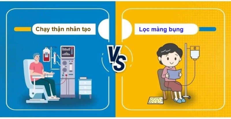 Lọc máu nhân tạo là phương pháp thay thế thận lọc thải các chất lỏng và chất độc dư thừa ra khỏi cơ thể