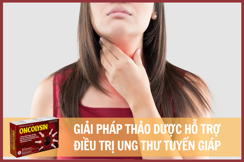 Oncolysin - Giải pháp thảo dược hỗ trợ điều trị ung thư tuyến giáp