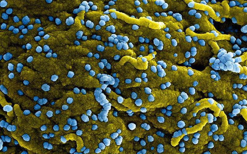 Virus Marburg (màu xanh lam), vừa sinh sôi và gắn trên bề mặt của các tế bào bị nhiễm bệnh (màu vàng). (Ảnh: VTV)