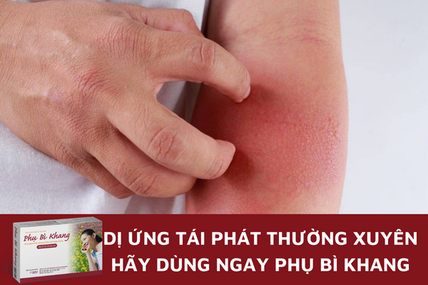 Dị ứng tái phát thường xuyên hãy dùng ngay Phụ Bì Khang