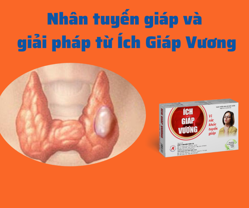 Tìm hiểu về nhân tuyến giáp và giải pháp từ Ích Giáp Vương