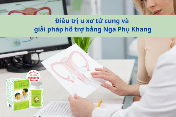 Phương pháp điều trị u xơ tử cung và giải pháp hỗ trợ bằng Nga Phụ Khang
