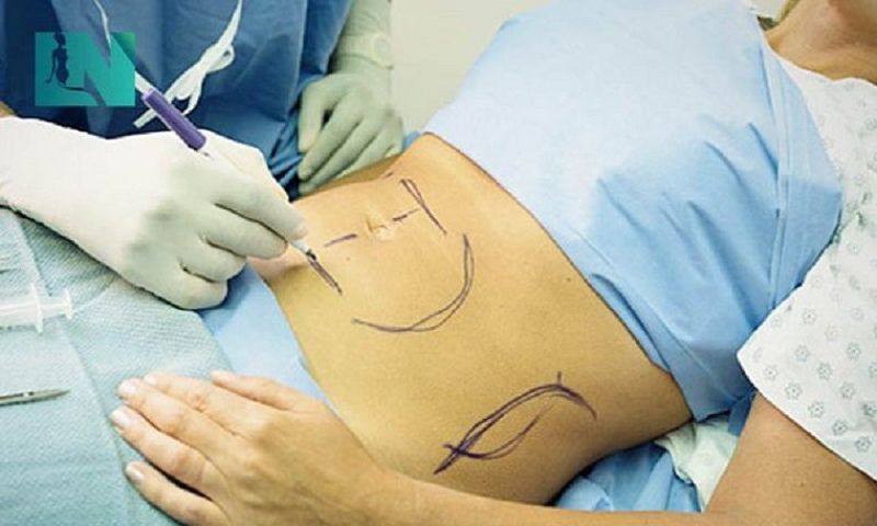 Thanh tra Sở Y tế TP. Hồ Chí Minh thông tin về trường hợp sự cố y khoa sau phẫu thuật thẩm mỹ