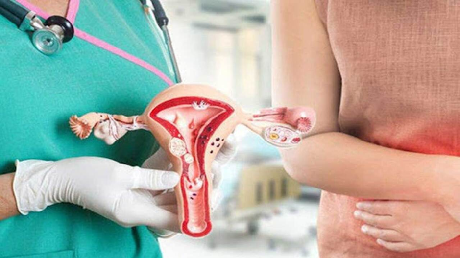 U xơ tử cung là bệnh lý phụ khoa đang ngày càng trở nên phổ biến
