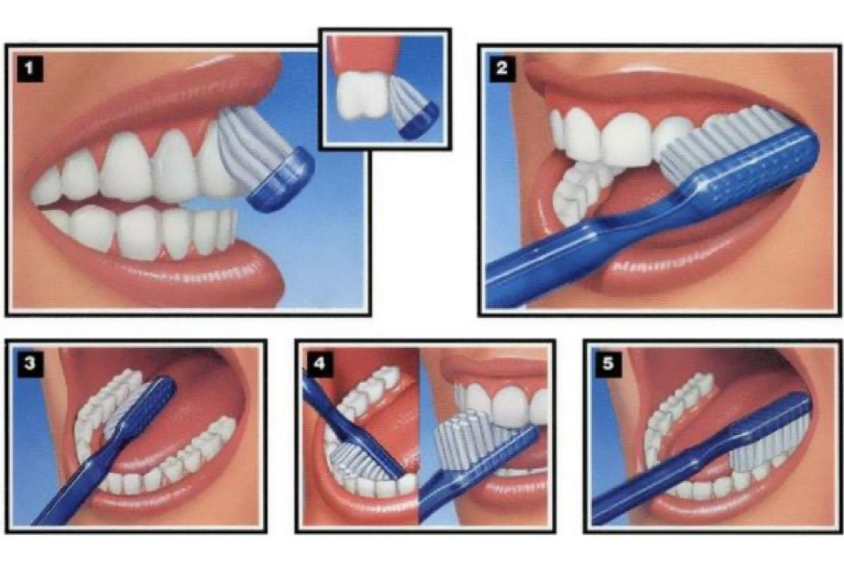 Vệ sinh răng miệng đúng cách bằng bàn chải lông mềm Vệ sinh răng miệng đúng cách bằng bàn chải lông mềm