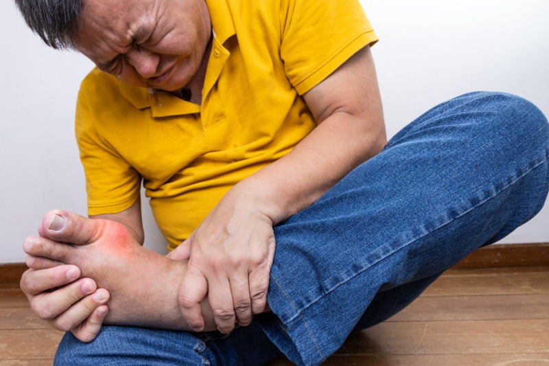 Gút thường gây đau nhức dữ dội tại khớp ngón chân cái