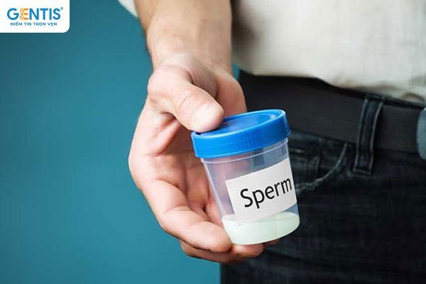 GENTIS chính thức ra mắt xét nghiệm Sperm DNA để hỗ trợ bác sĩ đánh giá toàn diện về chất lượng tinh trùng của người bệnh.