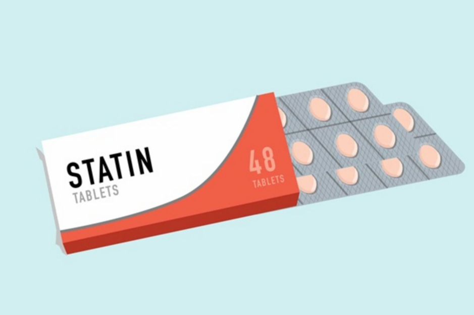 Statin là nhóm thuốc hạ mỡ máu phổ biến để điều trị xơ vữa do mỡ máu cao
