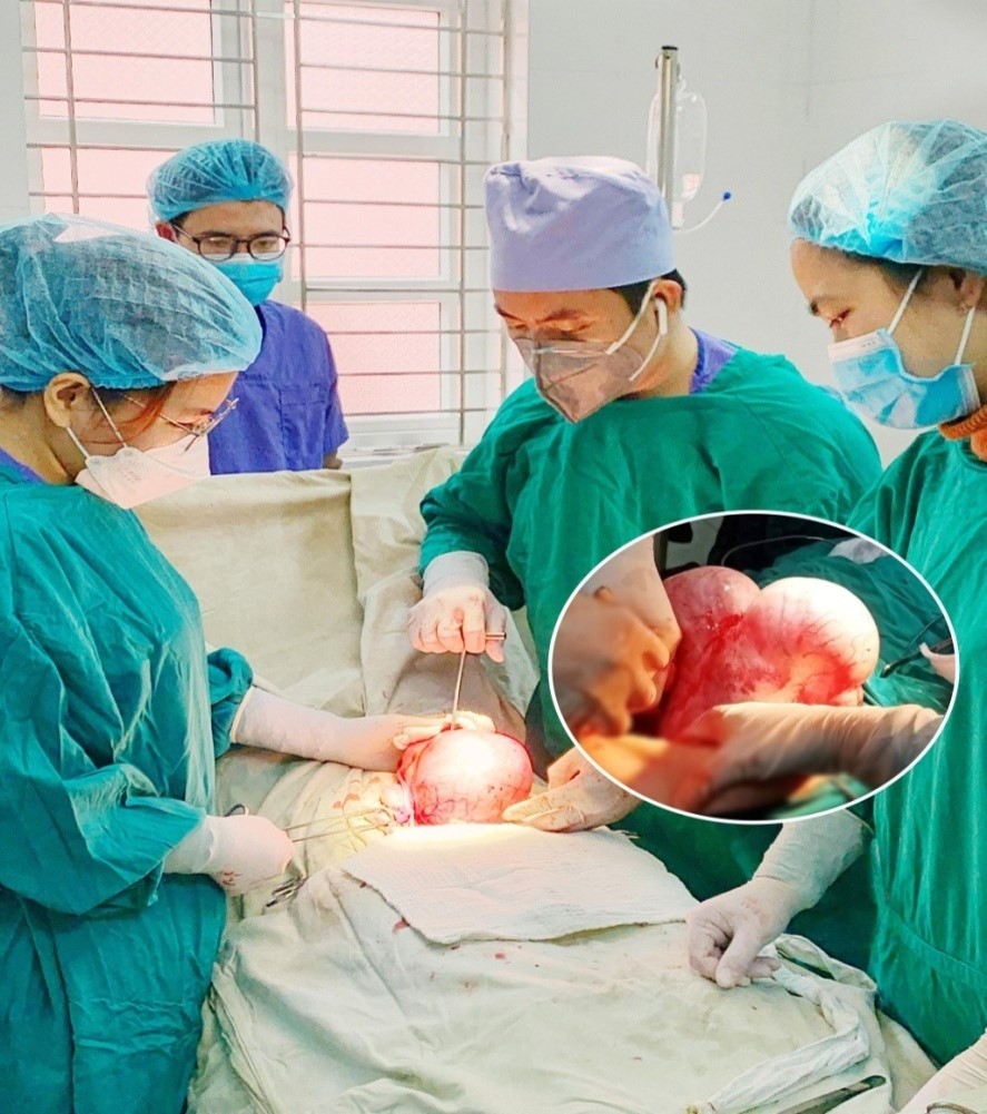 Các bác sỹ bệnh viện thực hiện phẫu thuật nội soi chửa ngoài tử cung vỡ, u xơ tử cung