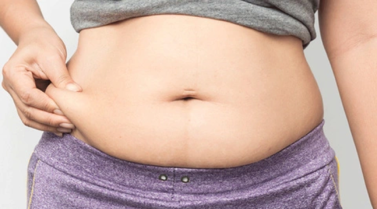 Những người phụ nữ béo phì có nguy cơ cao mắc đa nang buồng trứng hơn bình thường