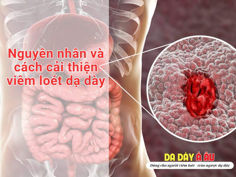 Loét dạ dày: nguyên nhân và cách cải thiện từ Dạ Dày Á Âu