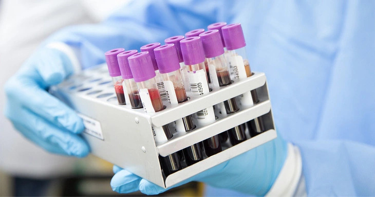 Các chỉ số xét nghiệm máu nhằm phát hiện bệnh ung thư chỉ mang tính định hướng