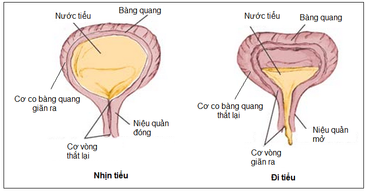 Đái dầm xảy ra do cơ bàng quang co thắt quá nhiều