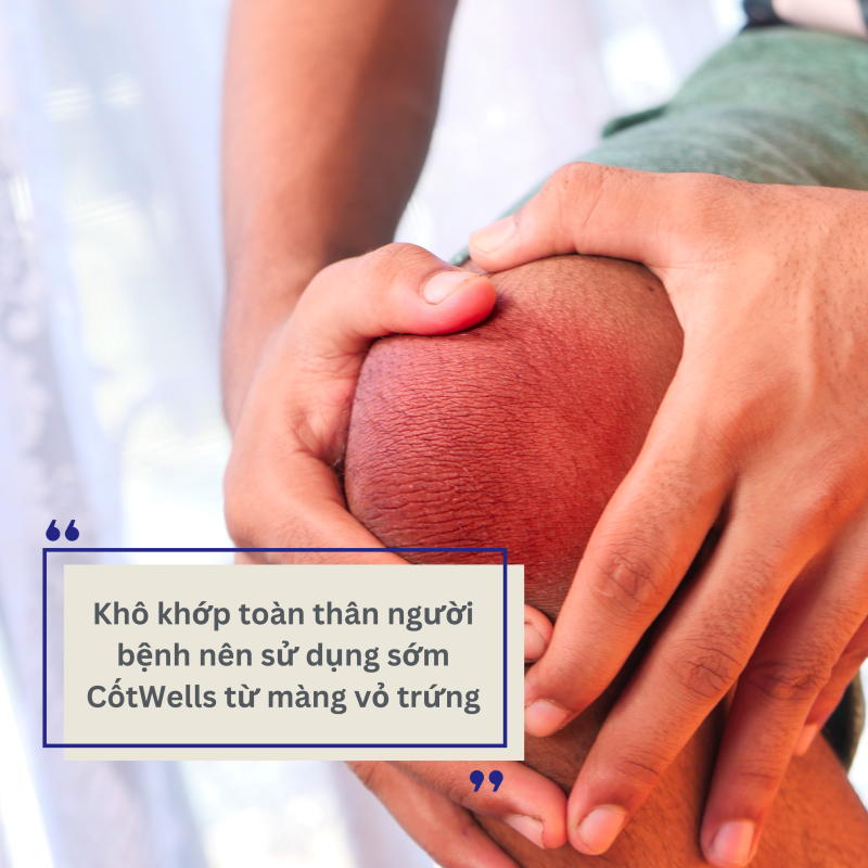Cách cải thiện khô xương khớp toàn thân và giải pháp từ CốtWells chứa màng vỏ trứng