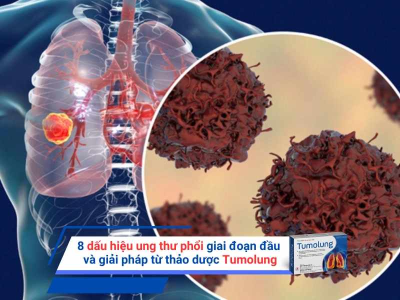 8 dấu hiệu ung thư phổi giai đoạn đầu và giải pháp từ thảo dược Tumolung