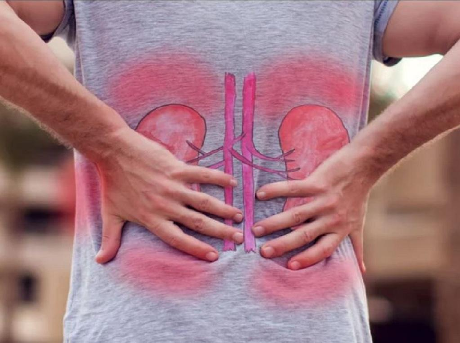 Tổn thương thận khi bị lupus ban đỏ