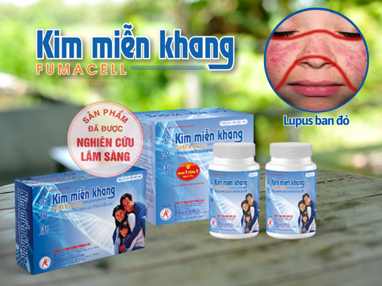 Kim Miễn Khang gi&uacute;p cải thiện bệnh lupus ban đỏ hiệu quả