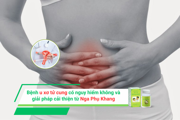 Bệnh u xơ tử cung có nguy hiểm không và giải pháp cải thiện từ Nga Phụ Khang