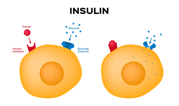 Cơ thể kháng insulin có thể dẫn đến bệnh buồng trứng đa nang