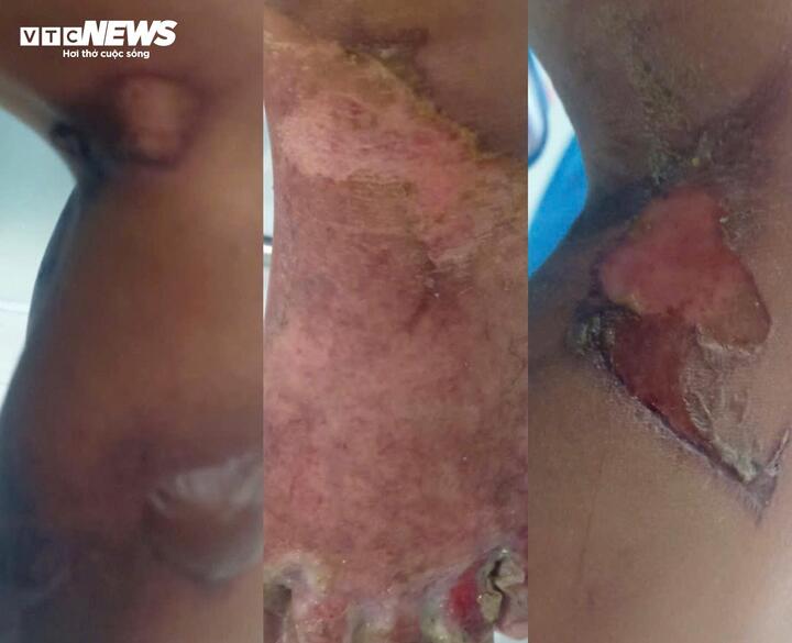 TPHCM: Truy tìm cha của bé trai 6 tuổi, nghi bạo hành con