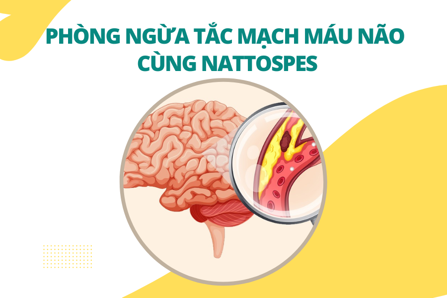 Phòng ngừa tắc mạch máu não cùng Nattospes