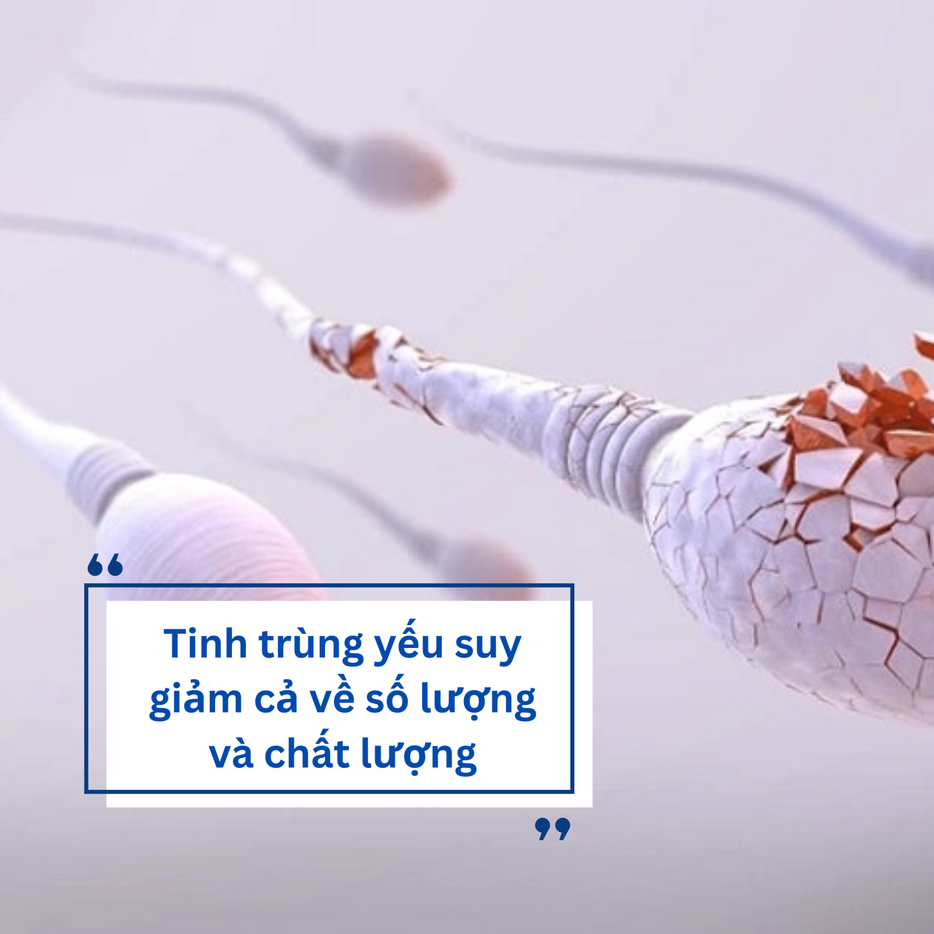 Nguyên nhân tinh trùng yếu và giải pháp cải thiện từ Linh Tự Đan
