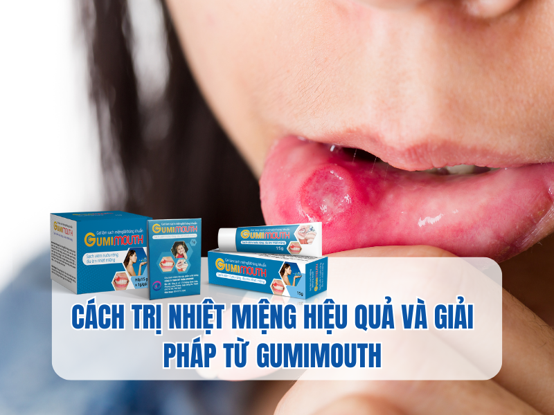 Cách trị nhiệt miệng hiệu quả và giải pháp từ Gumimouth