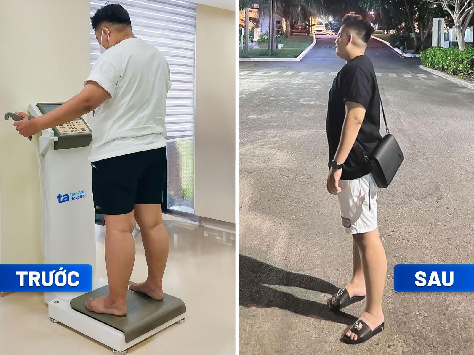 Người trẻ tìm địa chỉ giảm cân uy tín, chuẩn y khoa