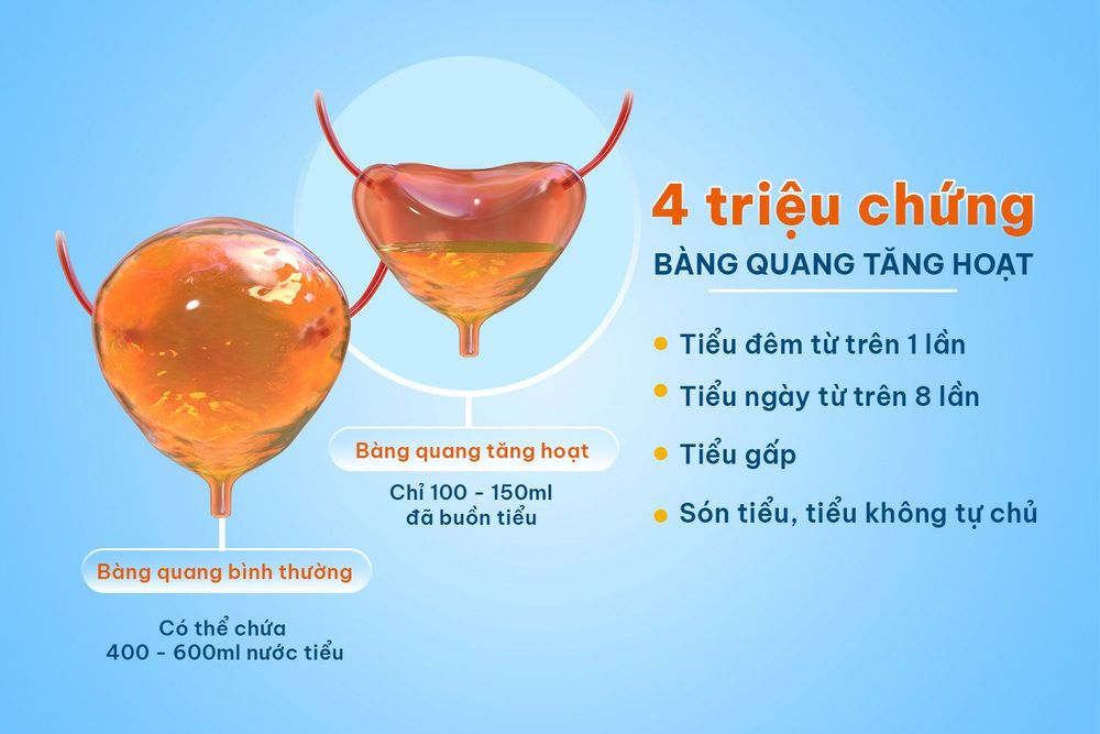 Bàng quang tăng hoạt là tình trạng phổ biến