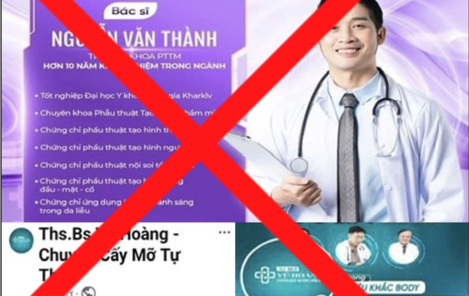 Trang Facebook quảng cáo trái phép “Bác Sĩ Thành - Chuyên hủy mỡ toàn thân“, “ThS.BS Vũ Hoàng - Chuyên cấy mỡ tự thân“. Ảnh: Sở Y tế TP. Hồ Chí Minh