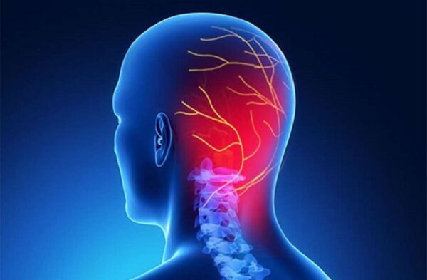 Thiếu máu não là nguyên nhân phổ biến gây ra cơn đau nửa đầu sau gáy Thiếu máu não là nguyên nhân phổ biến gây ra cơn đau nửa đầu sau gáy