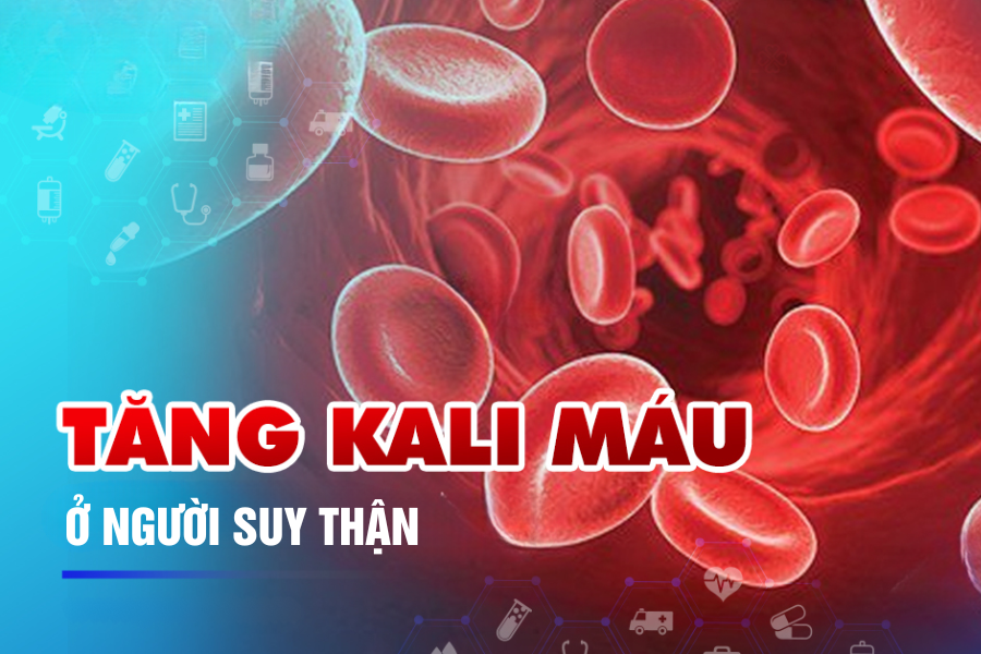 Cẩn trọng tăng kali máu ở người bị suy thận